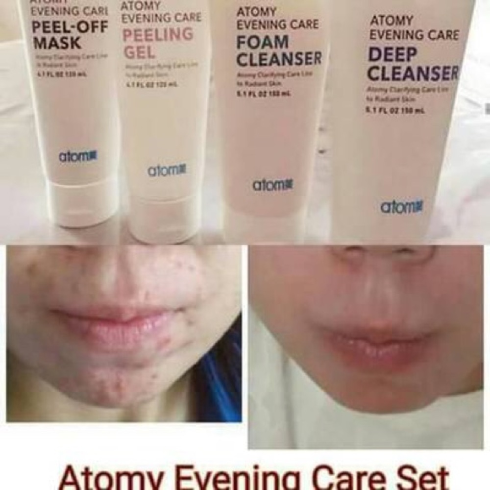 Using this 4step treatment - Picture 3 of 4
